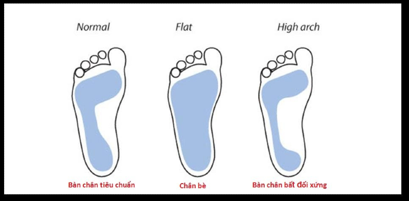 3 loại form chân cơ bản