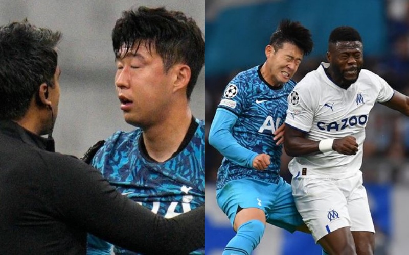 Son Heung-min phải tiến hành phẫu thuật vết rạn quanh mắt trái sau pha va chạm với Chancel Mbemba